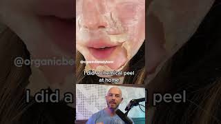 Reacting to this chemical peel thats done at home 🫣 credit organicbeautylover on TT [upl. by Osmo]