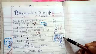 pathogenesis of colorectal cancer NGMedicals [upl. by Kyl]