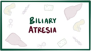 Biliary atresia  causes symptoms diagnosis treatment amp pathology [upl. by Zeph]