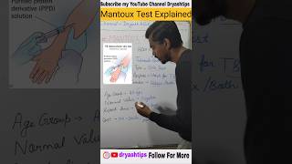 Mantoux Test Explained dryashtips education [upl. by Orme]