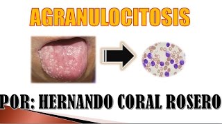 AGRANULOCITOSIS  INSUFICIENCIA DE NEUTROFILOS [upl. by Amre735]