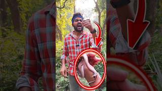 আবারও সাপের ছোবলে কাহিল শাশ্বত Snake Bite Video  Shaswata Ghosh Snake Video [upl. by Jecoa]