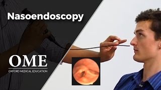 Nasoendoscopy Nose Examination  ENT [upl. by Crandall]