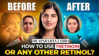 How to use TRETINOIN Cream ❌🚀 RETINOIDS Explained in detail By DERMATOLOGIST✅  Dr Aparajita Lamba [upl. by Ennovihc]