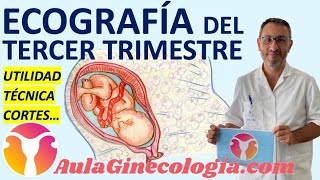 ECOGRAFÍA DEL TERCER TRIMESTRE TÉCNICA CORTE por CORTE UTILIDAD  Ginecología y Obstetricia [upl. by Hufnagel40]