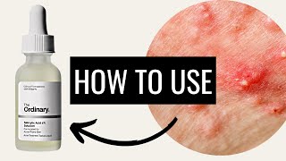 How To Use The Ordinary Salicylic Acid 2 Solution [upl. by Einitsed]