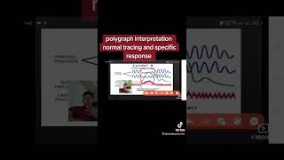 Polygraph reading and interpretation Normal Tracing and Specific response [upl. by Wiedmann770]