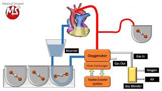 Cardiopulmonary bypass CPB circuit [upl. by Enamrahs]