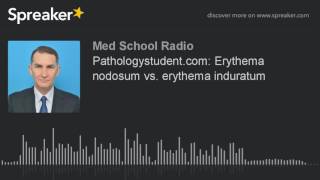 Pathologystudentcom Erythema nodosum vs erythema induratum made with Spreaker [upl. by Nalliuq]