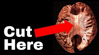 The Unsettling Truth about Human Consciousness  The Split Brain experiment that broke neuroscience [upl. by Zadack590]