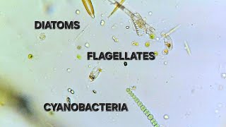 Diatoms Flagellates and a Cyanobacteria  400x [upl. by Isied843]