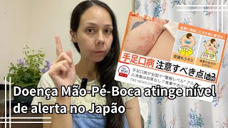 Doença MãoPéBoca atinge nível de alerta no Japão [upl. by Pearlstein829]