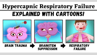 Hypercapnic type 2 respiratory failure explained with cartoons [upl. by Haslam]