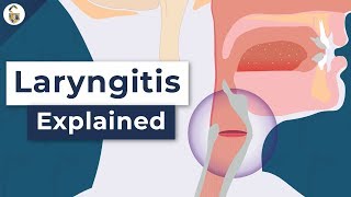 Why Do You Lose Your Voice  Laryngitis Explained [upl. by Clute335]