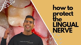 How to protect the LINGUAL NERVE when extracting third molarswisdom teeth [upl. by Naegem]