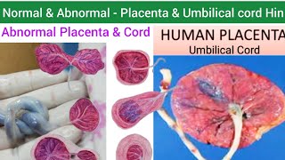 Human Placenta  Structure Function amp Abnormalities of Placenta amp Umbilical cord  Umbilical Cord [upl. by Ynnam713]