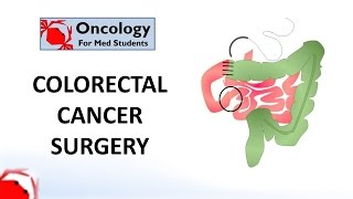 Colorectal Cancer Surgery principles and types [upl. by Ynohtnaluap]