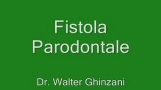 Fistola parodontale [upl. by Aurelius]