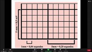 parámetros basicos del electrocardiograma [upl. by Macleod]