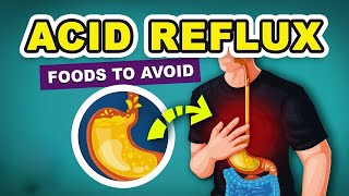 8 WORST foods that trigger Acid Reflux  how to reduce acid reflux [upl. by Tremann]