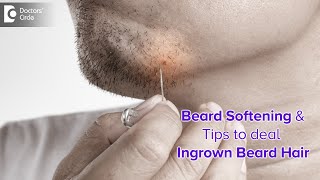 INGROWN BEARD HAIR  Ingrown facial hair in MEN Causes amp Treatment Dr Nischal K  Doctors Circle [upl. by Lavinie574]