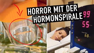 HORMONSPIRALE  Entfernung durch OP um € 1300  😱 Was dir davor niemand erzählt [upl. by Atterahs]