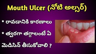 Mouth Ulcers Reasons and Treatment in Telugu [upl. by Alver]