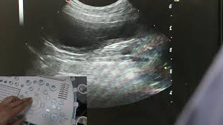 Optimising your ultrasound image [upl. by Anatnas]