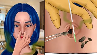 ASMR Very Satisfying navel stone removal animation‼️ Removing Pus from Piercing Piercing Cleaning [upl. by Alrak]