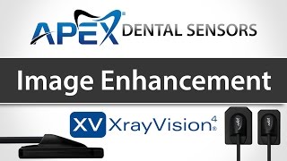 Apteryx XrayVision Image Enhancements  Apex Dental Sensors  Training [upl. by Wardlaw546]