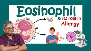 ইওসিনোফিল কি Why Eosinophils are SO Important for Your Body Role of eosinophils in allergy [upl. by Tennaj67]