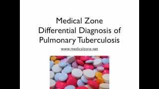 Medical Zone  Differential Diagnosis of Pulmonary Tuberculosis [upl. by Aivul]