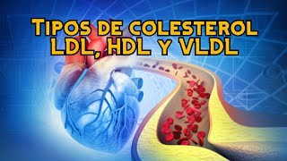 Tipos de colesterol LDL HDL y VLDL [upl. by Wesa637]