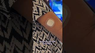 Testing the Medtronic Simplera CGM t1d diabetes [upl. by Nothgierc]