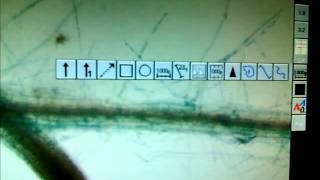 GUS Assay and root microscopy [upl. by Elagiba]