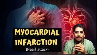 MYOCARDIAL INFARCTION MI  Heart attack in 20mins [upl. by Sallyanne]