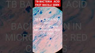 Acid fast bacilli T B bacteriashortvideobmlt dmlt medical mlt mbbs [upl. by Cissej523]