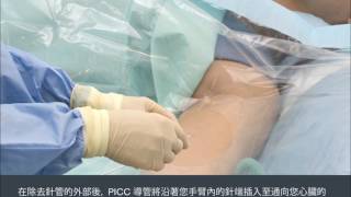 Having a Peripherally Inserted Central Catheter  PICC Chinese  裝置週邊插入主靜脈導管（PICC） [upl. by Annayi]