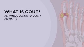 What is Gout An Introduction to Gouty Arthritis 1 of 6 [upl. by Yelnikcm]