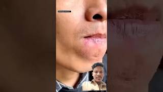 Dry skin dal skin only one product me colour change shortvideo skincareroutin skincare like [upl. by Calan]