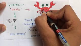 Lysosomal storage diseases mnemonic  USMLE  NEETPG  AIIMS [upl. by Aleakim]