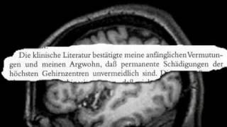 Verringerung der intellektuellen Fähigkeiten durch neuroleptische Behandlung [upl. by Nwahs]