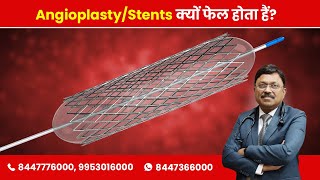 Why Angioplasty  Stents fail  Dr Bimal Chhajer  SAAOL [upl. by Alded]