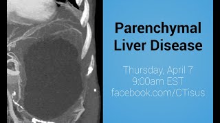 Facebook Live Parenchymal Liver Disease [upl. by Adianes]