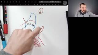 4a Steps for aesthetic crown lengthening Day 3 [upl. by Lielos]