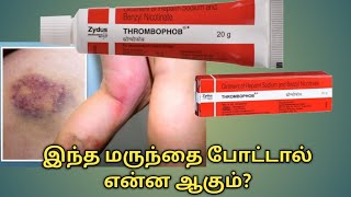 Thrombophob ointment uses in tamilThrombophob ointment benefits in tamilThrombophob ointment uses [upl. by Ardni]