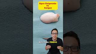 Água oxigenada X Sangue 😯🩸curiosidades medicina medico dicas experimento ciencia enfermagem [upl. by Akilam]