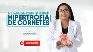 Hipertrofia de cornetes  Problemas respiratorios [upl. by Kiri]