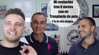 Vlog 5 Mi evolución tras 6 meses del trasplante de pelo y la de mis AMIGOS [upl. by Chelsae890]