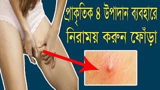 প্রাকৃতিক ৪ উপাদান ব্যবহারে নিরাময় করুন ফোঁড়া  Bangla Health Tips [upl. by Eatnoled]